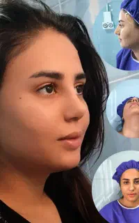 عمل بینی برای مراجعین الیگودرز/تهران/42میلیون
