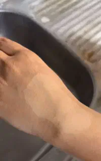 سفیدی پوست بدن با ضمانت