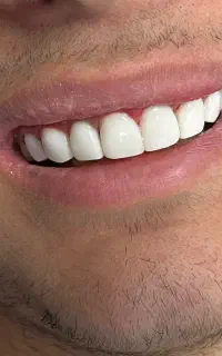 دستیار دندانپزشک