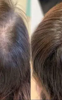 این آخرین روشیه که امتحان میکنی