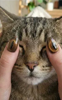 کاشت ناخن فوق تخصصی با ما