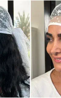 میکروکاشت ابرو با روش اختصاصی کلینیک مهرزاد