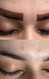 پاک کردن انواع تتوهای صورت(ابرو،خط چشم، خط لب)