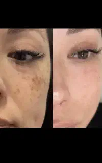 صابون بیوممتیک