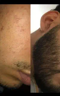 تردمیل برو، ریشت بلندتر شه