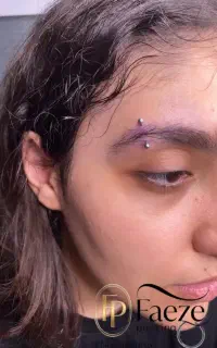 پیرسینگ گوش بینی لب ناف میکرودرمال کاشت نگین