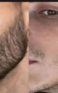 ریش داشته باش تا ریشه دار باشی