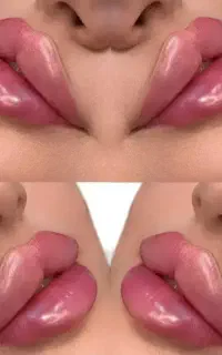 تزریق ژل بوتاکس فیلر لیزر فشیال در کلینیک زیبایی