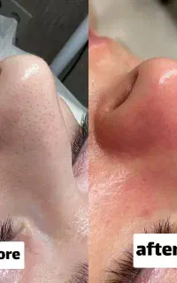 فشیال تخصصی صورت