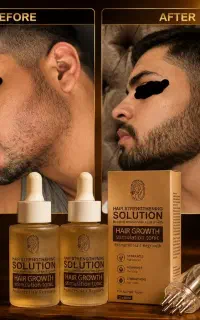 معجزه رشد ریش و موهات تو سی روز