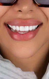 لمینت  مرکز تخصصی لمینت