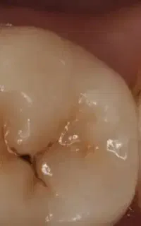خدمات دندانپزشکی رایگان