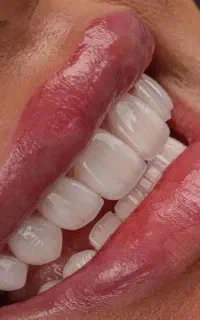 دندانپزشکی زیبایی