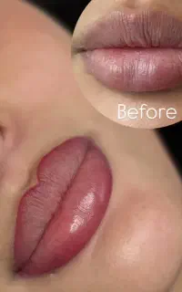 تاتو صورت تضمینی ،فیبروز