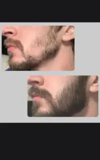 چرا بدون مو و ریش موندی