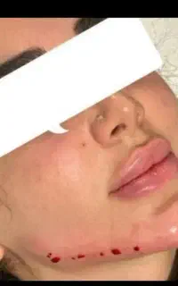پک ژل باتخفیف