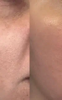 فیشال کار- اپراتور لیزر-اسکالپ سر