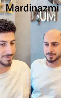 کلینیک پروتز مو ماردین عظمی