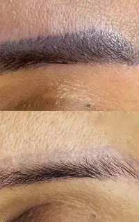 ریمو تتوهای قدیمی ابرو و خط چشم