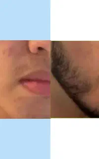 بمب معجزه