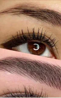 مدل برای فیبروز