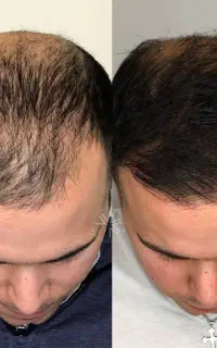 مرحله بعد بازی موهای جذاب
