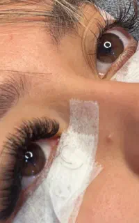 کاشت مژه فقط هزینه مواد