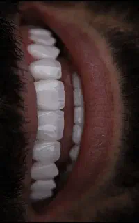 دندانپزشکی و ایمپلنت با شرایط اقساطی