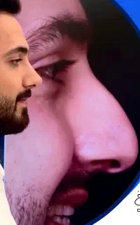 عمل بینی با شرایط فوق العاده