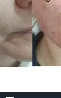 آموزش و خدمات پلکسر(پلاسما)