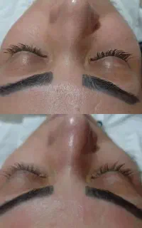 فشیال پاکسازی پوست