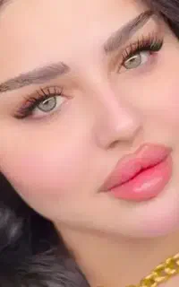 فیلر، مزو، پی ار پی، بوتاکس