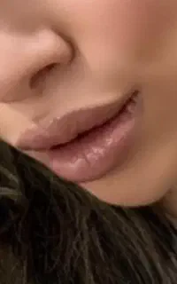 جشنواره فیلرلب زوایه فک وبوتاکس،لیفت با نخ،مزووایت