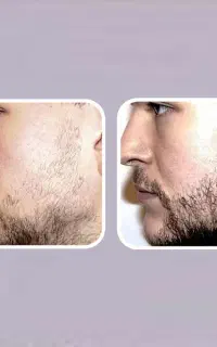 بلیت کنسرت ریشو ها ۲