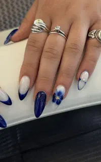 بعد پنج بار خدمات ژلیش پا (رایگان)