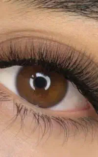 کاشت مژه ۵۰۰