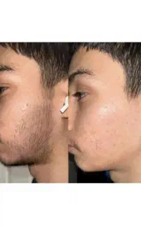 کف دستات هم پشم رشد می‌کنه