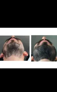 بی دردسر اعتمادبه نفس رو به خودت هدیه بده