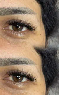 چند مدل برای کاشت هیدن