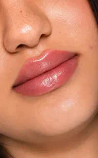 فیلر و بوتاکس