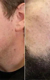 تار ریشاتون اذیت کرد