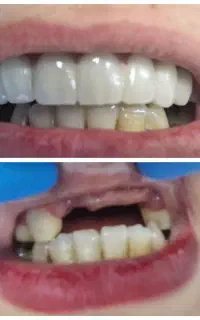 ارائه خدمات دندانپزشکی(کاریزما)
