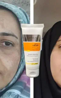سفیدشو درمان کک و مک و لک