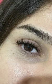کاشت مژه