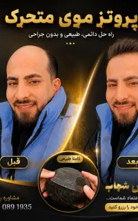 پروتز موی سینمایی vip