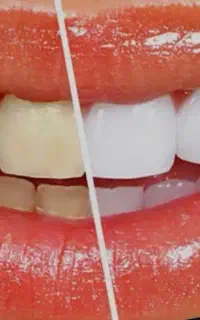 خدمات دندانپزشکی