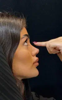 جشنواره جراحی بینی