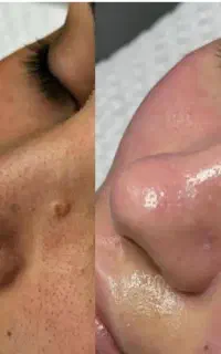 فشیال تخصصی پوست
