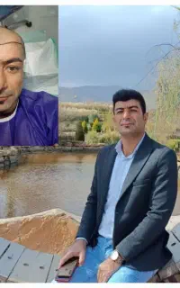 جشنواره کاشت ابرو و مو