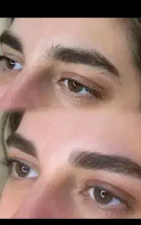 اصلاح صورت و ابرو تخصصی